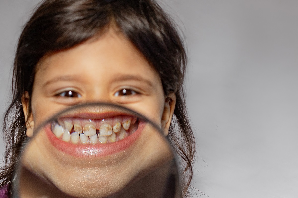 Co prozradí zuby o zdraví dítěte? Zaměřte se na tohle