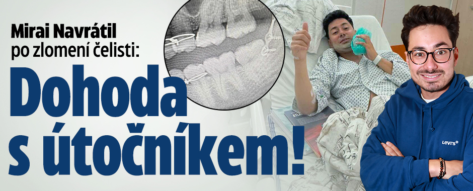 Mirai Navrátil po zlomení čelisti: Dohoda s útočníkem!