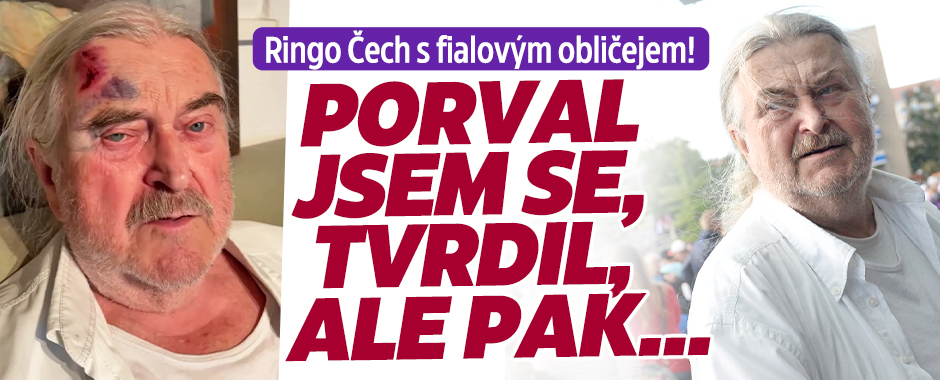 Ringo Čech s fialovým obličejem: Porval jsem se, tvrdil...