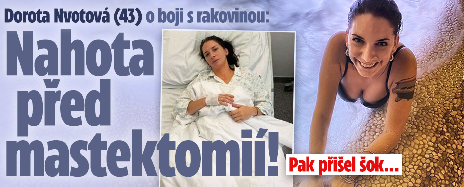 Banner ke žhavému tématu: Nvotová (43) o boji s rakovinou: Nahota ...