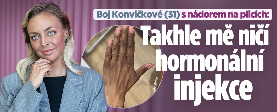 Boj Konvičkové s nádorem na plicích: Takhle mě ničí injekce