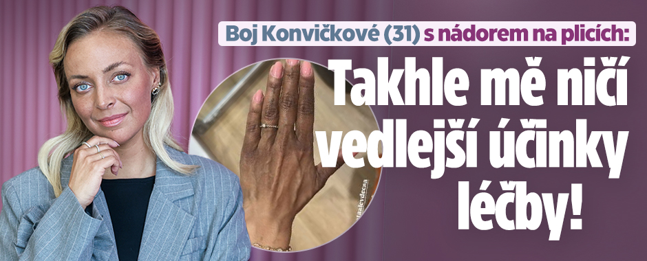 Boj Konvičkové s nádorem na plicích: Takhle mě ničí vedlejší účinky léčby