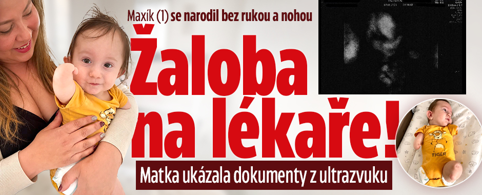 Banner ke žhavému tématu: Maxík se narodil bez končetin: Žaloba ...