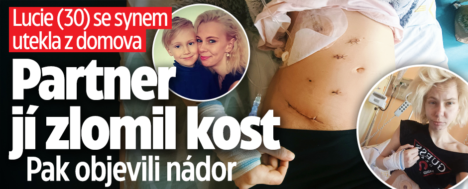 Banner ke žhavému tématu: Lucie (33) se synem utekla z domova: ...