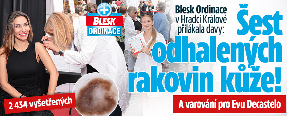 Banner ke žhavému tématu: Blesk Ordinace v Hradci: Šest ...