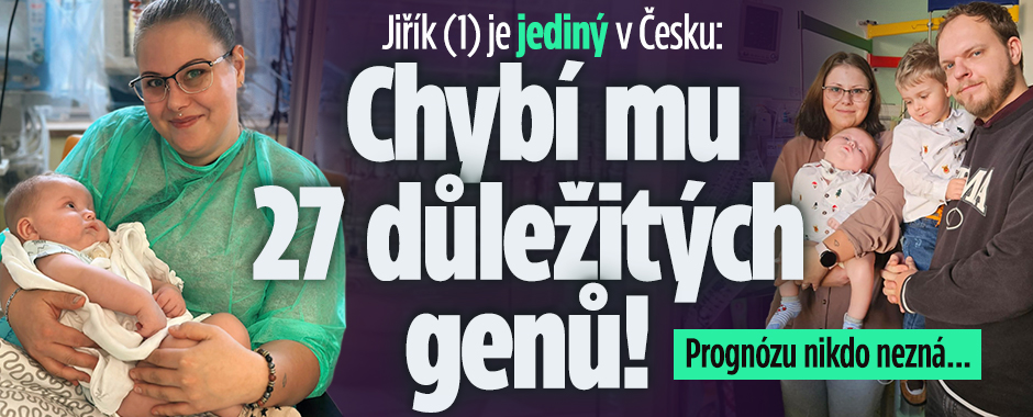 Banner ke žhavému tématu: Jiřík (1) je jediný v Česku: Chybí mu ...