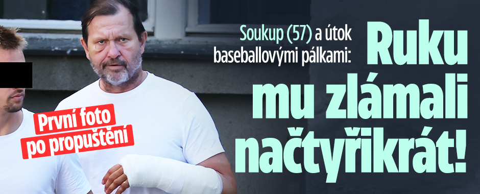 Banner ke žhavému tématu: Soukup (57) a útok pálkami: Ruku mu ...