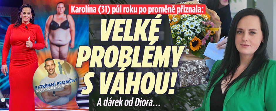 Karolína po proměně přiznala: Velké problémy s váhou! 