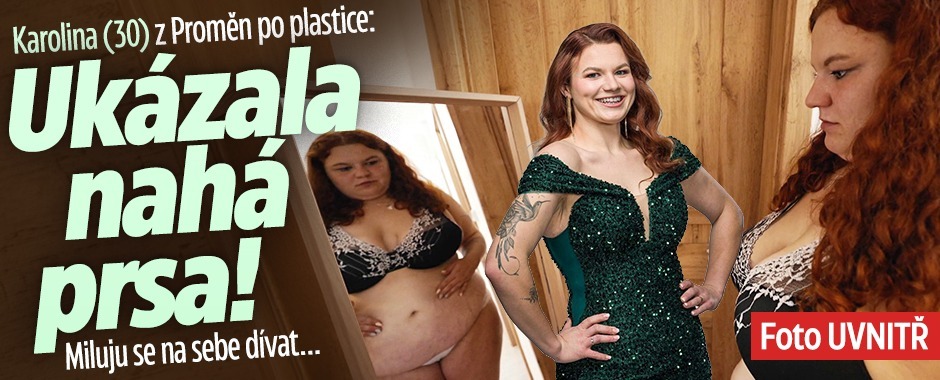 Banner ke žhavému tématu: Karolina (30) z Proměn po plastice: ...