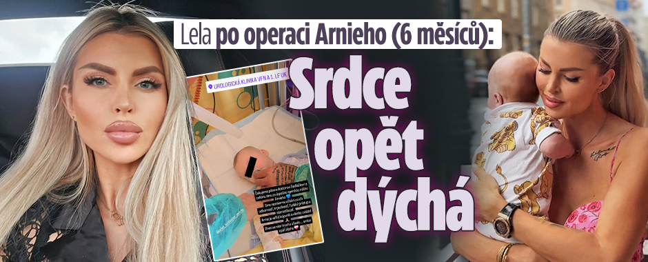 Banner ke žhavému tématu: Lela po operaci Arnieho (6 měsíců): ...