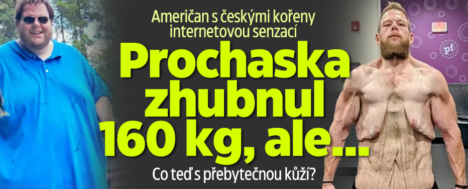 Američan s kořeny z ČR je senzací: Prochaska zhubnul 160 kg