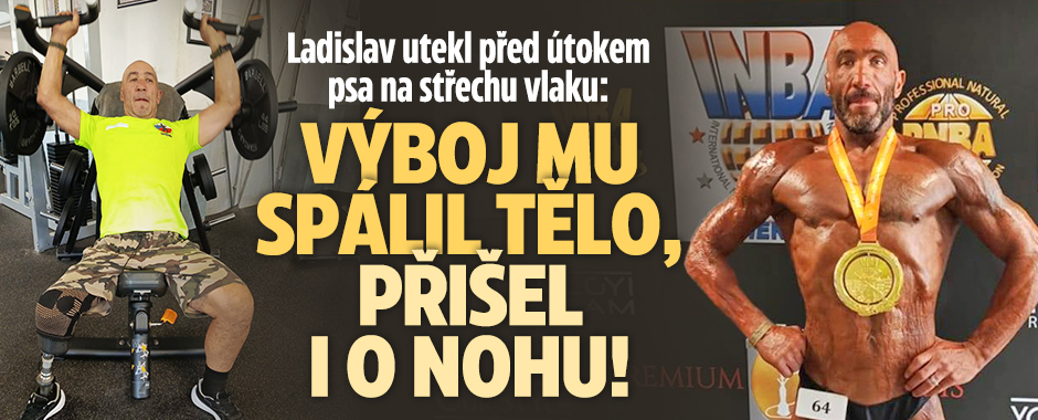 Banner ke žhavému tématu: Ladislavovi výboj spálil tělo, přišel i ...