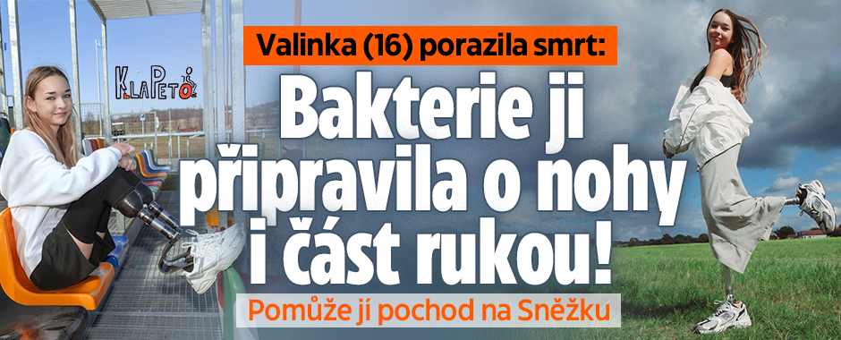 Valinka porazila smrt: Bakterie ji připravila o končetiny