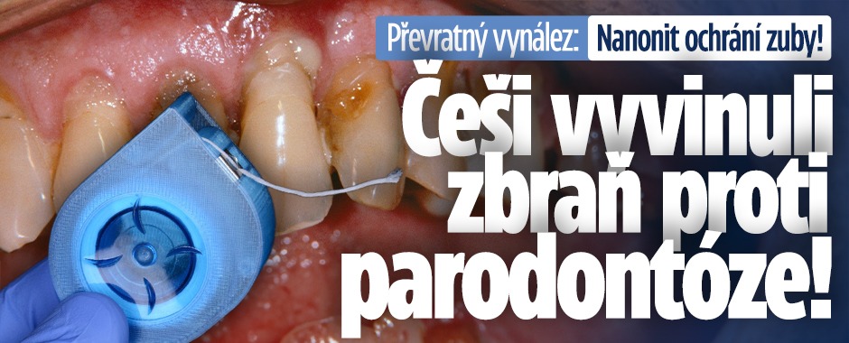 Banner ke žhavému tématu: Převratný vynález: Češi vyvinuli zbraň ...