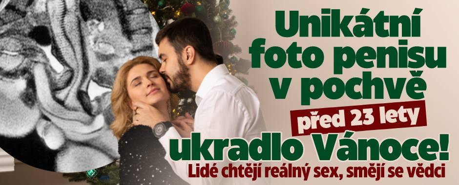 Banner ke žhavému tématu: Unikátní foto penisu v pochvě před 23 ...