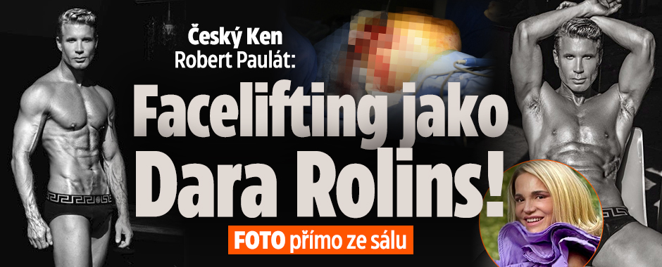 Český Ken Robert Paulát: Facelifting jako Dara Rolins!