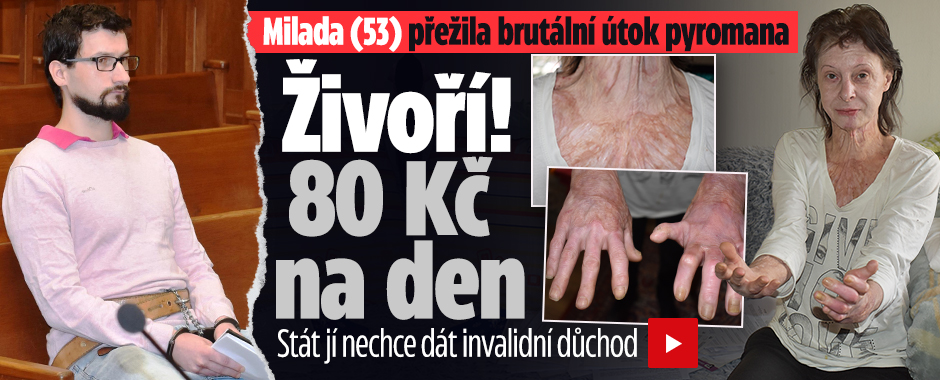 Banner ke žhavému tématu: Miladu málem upálil kriminálník: ...