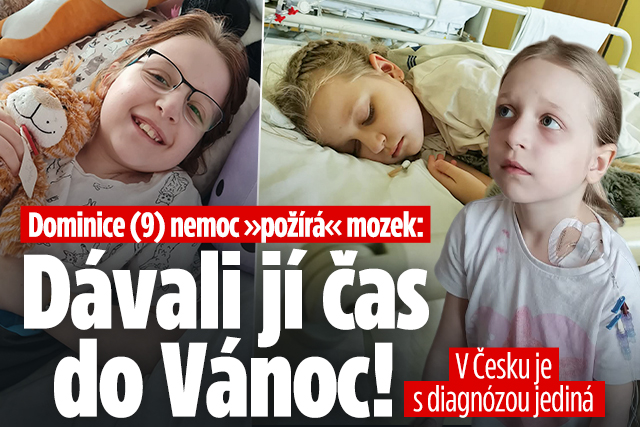 Banner ke žhavému tématu: Dominice (9) nemoc »požírá« mozek: ...
