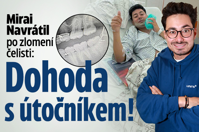 Mirai Navrátil po zlomení čelisti: Dohoda s útočníkem!