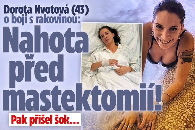Banner ke žhavému tématu: Nvotová (43) o boji s rakovinou: Nahota ...