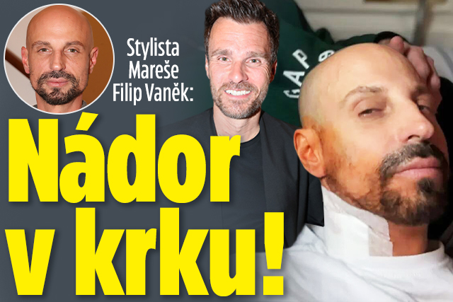 Banner ke žhavému tématu: Stylista Mareše Vaněk: Nádor v krku!