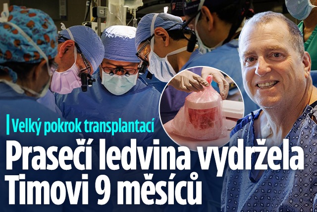 Banner ke žhavému tématu: Pokrok transplantací: Prasečí ledvina ...