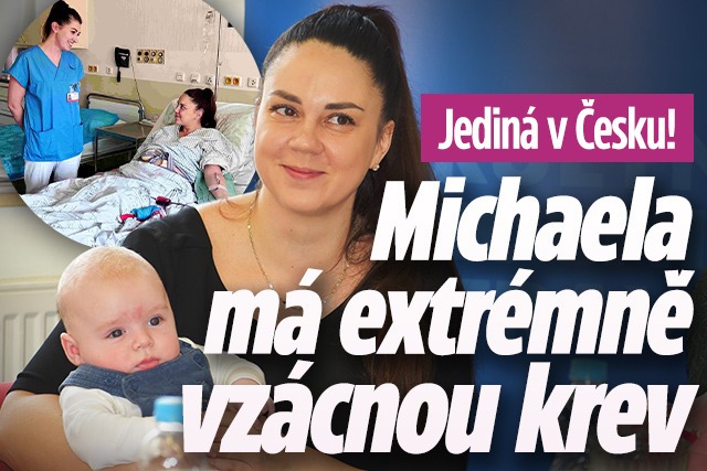 Banner ke žhavému tématu: Michaela má jako jediná v Česku vzácnou ...