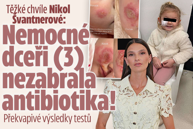 Banner ke žhavému tématu: Strach Nikol Švantnerové: Dceři (3) ...