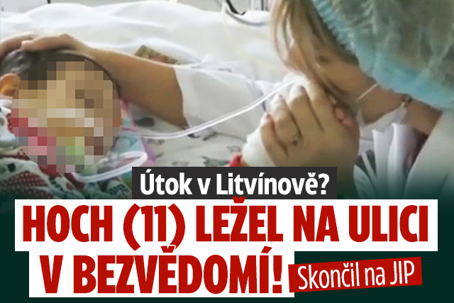 Banner ke žhavému tématu: Útok v Litvínově? Hoch (11) ležel na ...