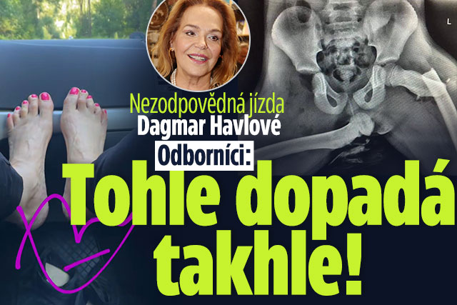 Nezodpovědná jízda Havlové: Sem nohy za jízdy nepatří!