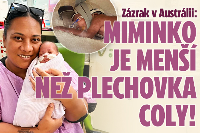 Banner ke žhavému tématu: Miminko (351g) přepsalo historii: ...