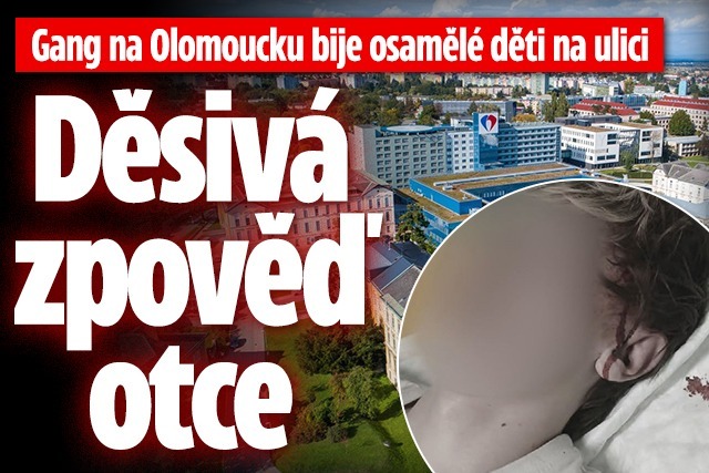 Banner ke žhavému tématu: Gang na Olomoucku bije osamělé děti na ...