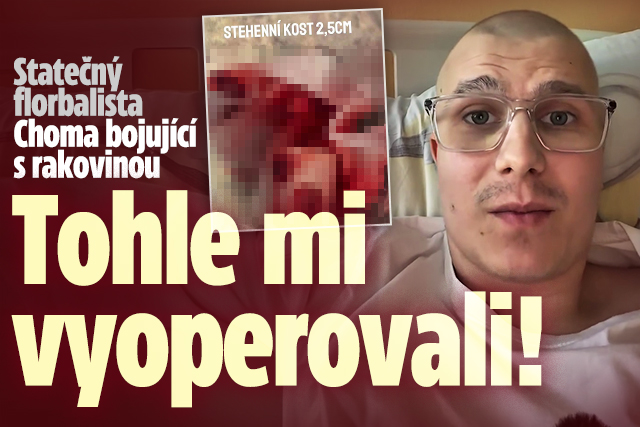 Banner ke žhavému tématu: Bojovník s rakovinou Choma: Tohle mi ...
