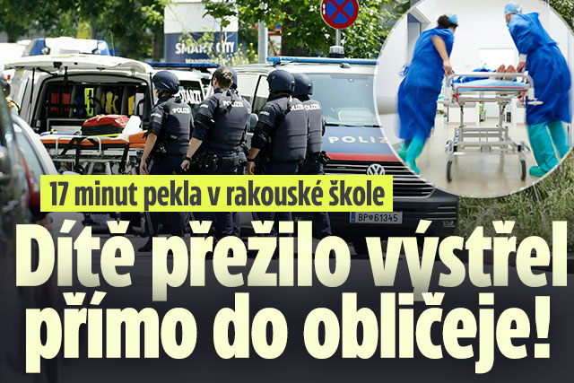 17 minut pekla: Dítě přežilo výstřel přímo do obličeje!