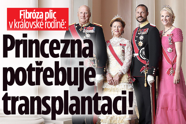 Banner ke žhavému tématu: Fibróza v královské rodině: Princezna ...