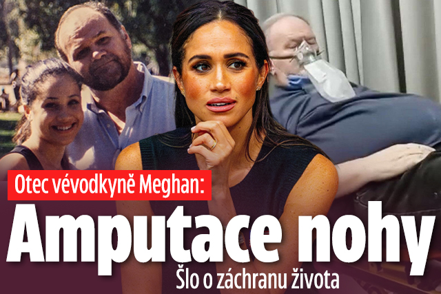 Banner ke žhavému tématu: Otec vévodkyně Meghan: Amputace nohy! ...