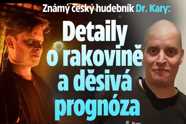 Český zpěvák Dr. Kary: Detaily o rakovině a děsivá prognóza