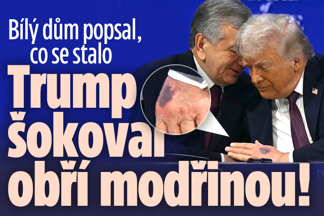 Banner ke žhavému tématu: Trump překvapil obří modřinou: Co se ...