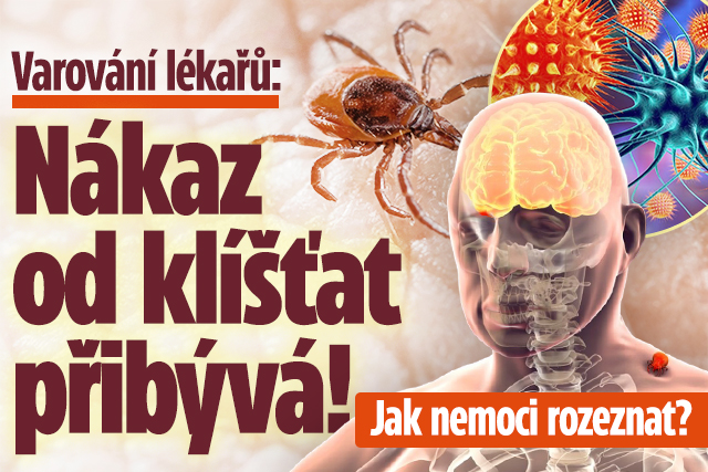 Varování lékařů: Klíšťata v Česku letos nakazila už 1810 lidí. Jak nemoci rozeznat?