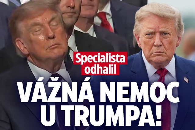 Banner ke žhavému tématu: Specialista odhalil: Vážná nemoc u ...