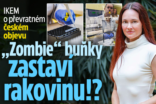 Banner ke žhavému tématu: IKEM o českém objevu  „Zombie“ buňky ...