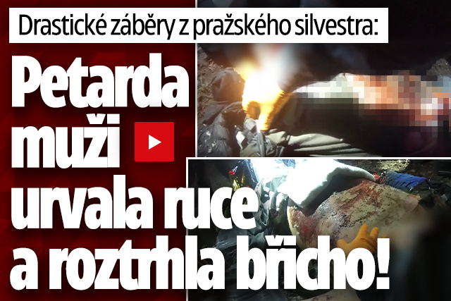 Banner ke žhavému tématu: Výbuch petardy muži v Praze amputoval ...