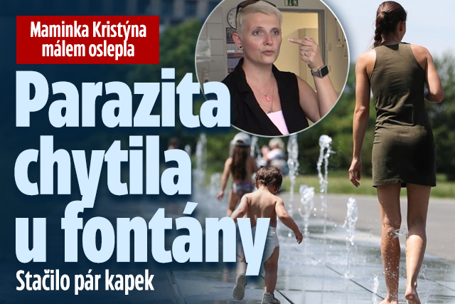 Maminka Kristýna málem oslepla: Parazita chytila u fontány!