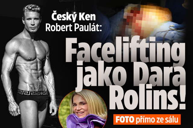 Český Ken Robert Paulát: Facelifting jako Dara Rolins!