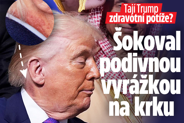 Banner ke žhavému tématu: Trump šokoval vyrážkou: Tají zdravotní ...