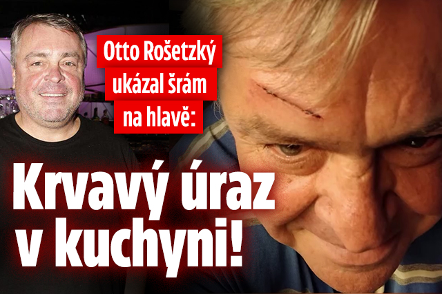 Banner ke žhavému tématu: Otto Rošetzký ukázal šrám na hlavě: ...