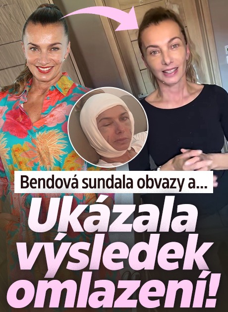 Banner ke žhavému tématu: Bendová sundala obvazy a… Ukázala ...