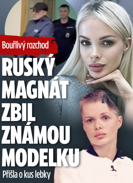 Banner ke žhavému tématu: Ruský magnát zbil známou modelku: ...