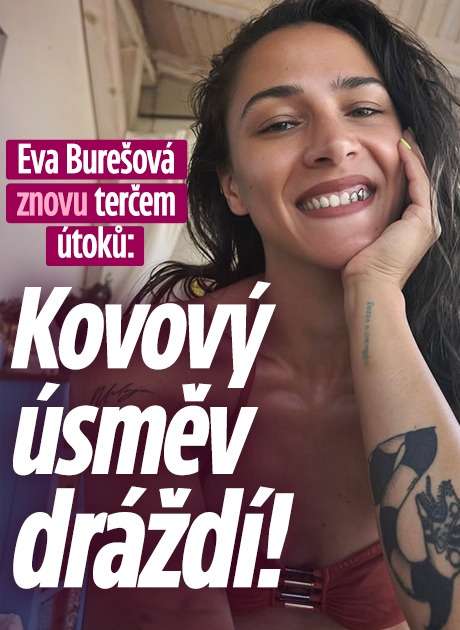 Banner ke žhavému tématu: Eva Burešová za kovový úsměv sklízí bídu