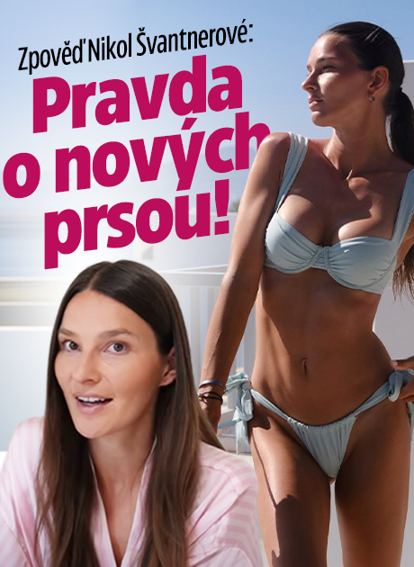 Zpověď Nikol Švantnerové: Pravda o nových prsou!